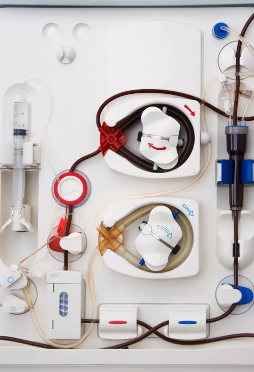 EBE Fuellstand dialisis aplicacion w